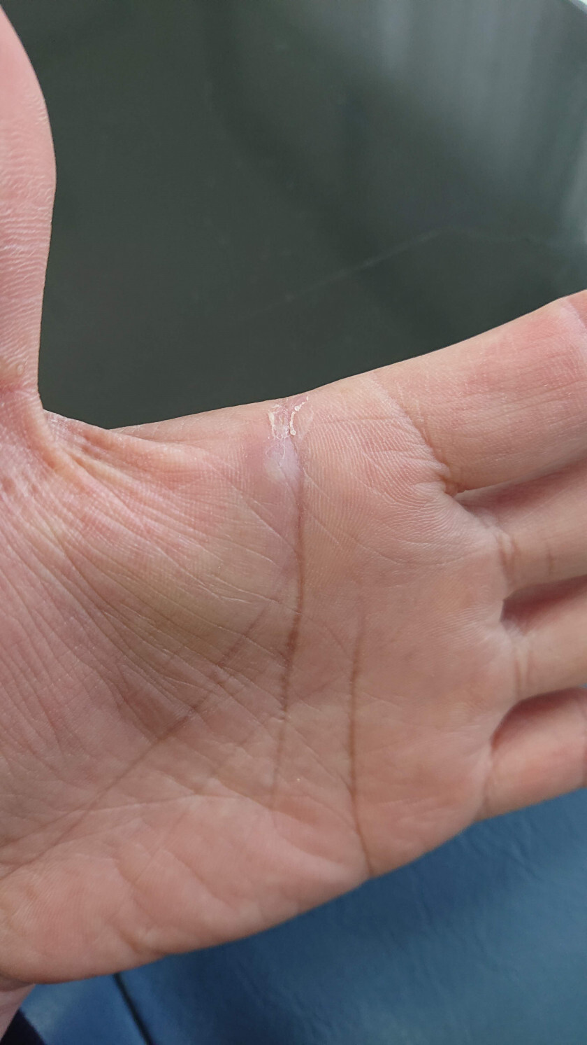 2021.04.10 23:43　トゲ